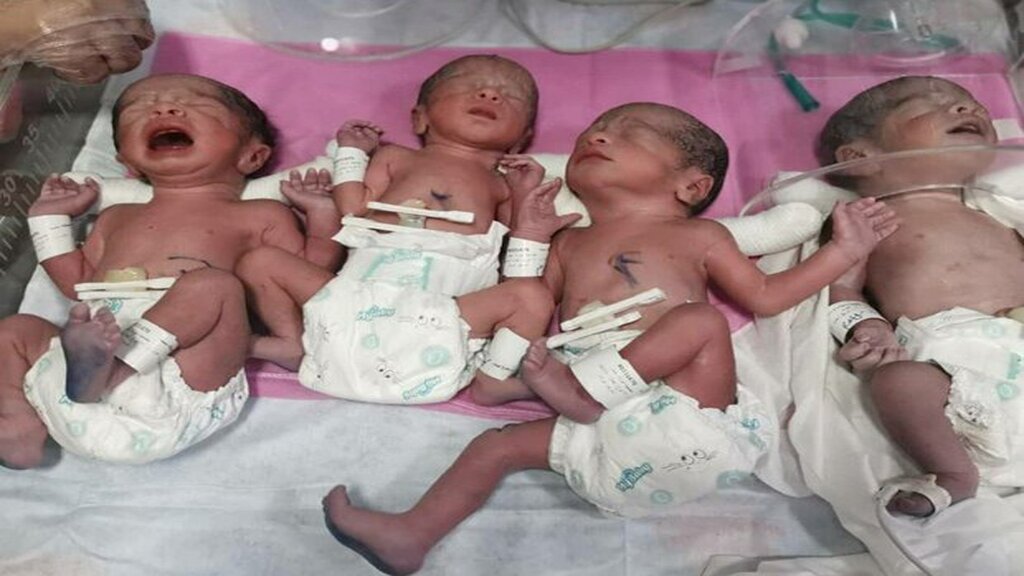 تولد چهارقلوها در یزد