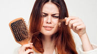 بیماری ریزش مو چیست؟